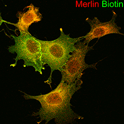 An image showing Merlin and Merlin-interacting proteins.